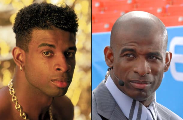 Deion Sanders Gets FUE Hair Transplant